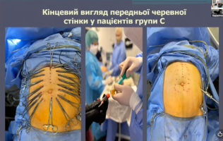 захист дисертації Віталія ЦІЛЮРИКА