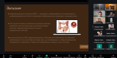 засідання гуртка нейроендокринних пухлин